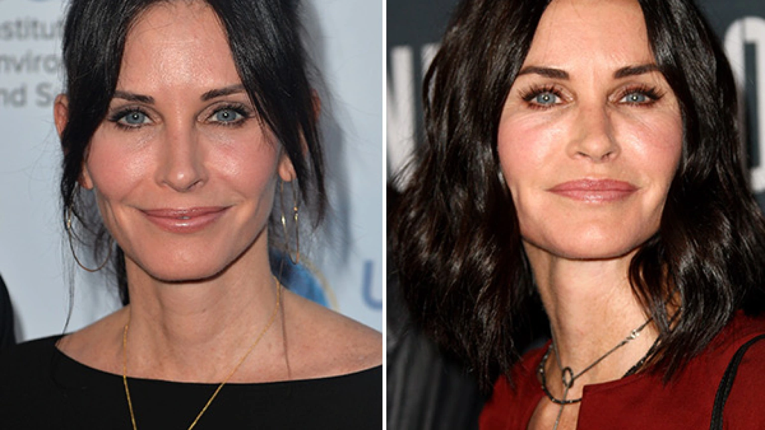 Raffi Hovsepian, MD Blog | Courteney Cox: Has She Had Plastic Surgery? Expert Speaks