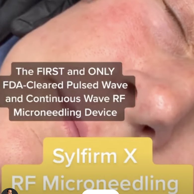 Raffi Hovsepian, MD