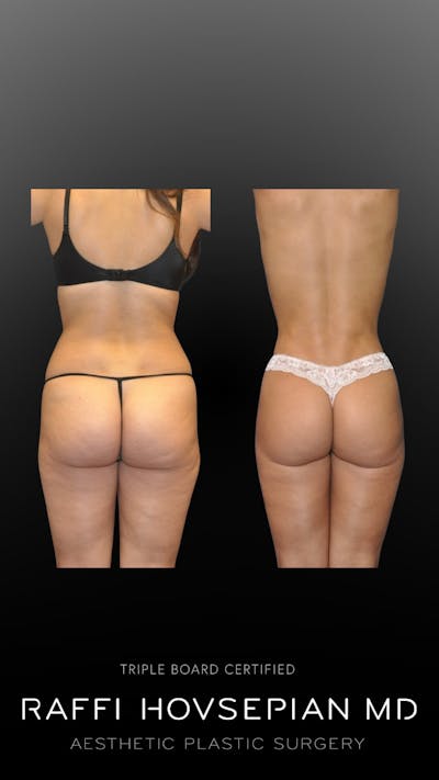 Procedures Before & After Gallery - Patient 758255 - Image 1