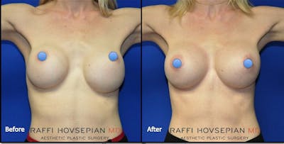 Procedures Before & After Gallery - Patient 501809 - Image 1