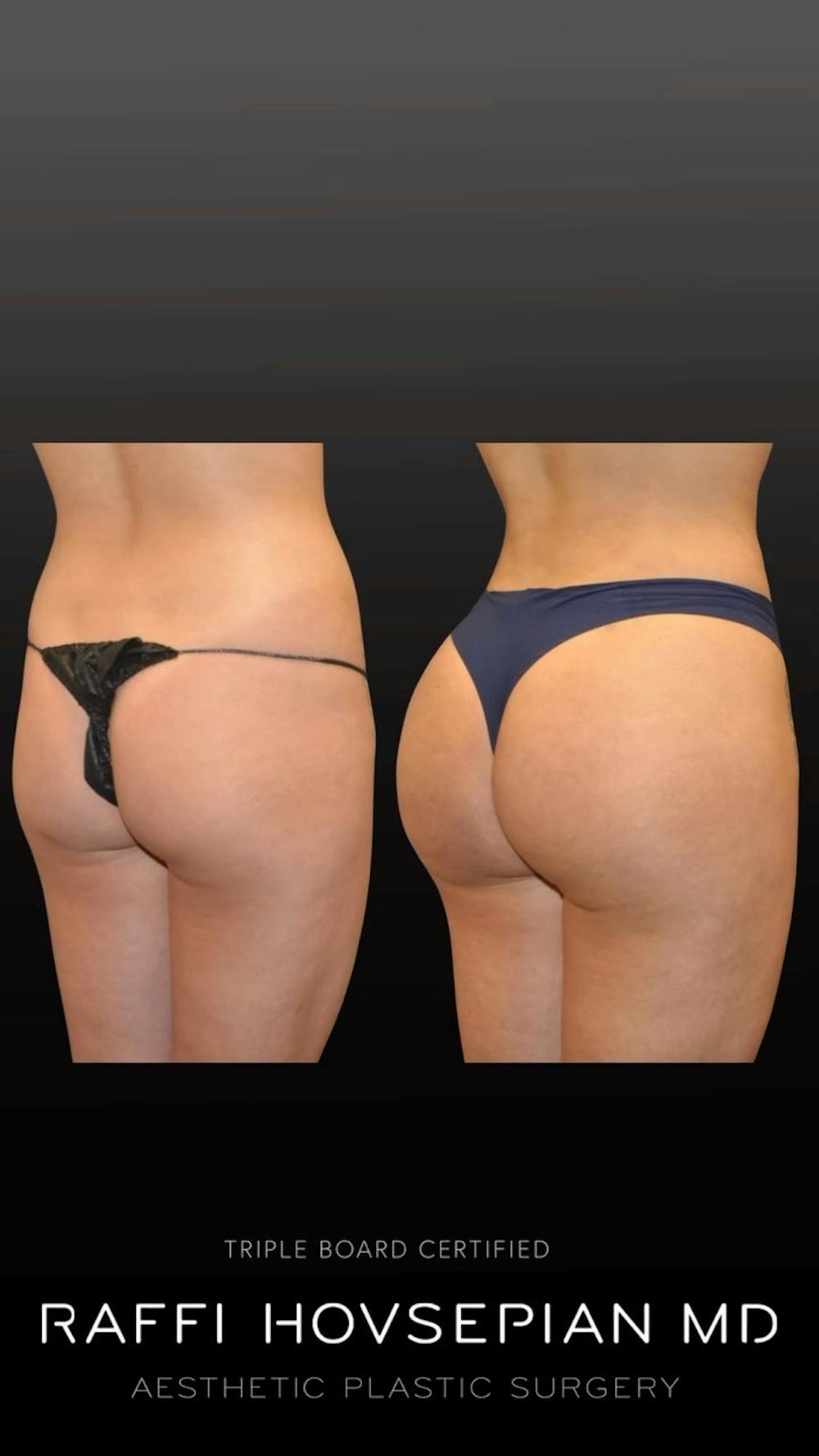 Procedures Before & After Gallery - Patient 243545 - Image 1