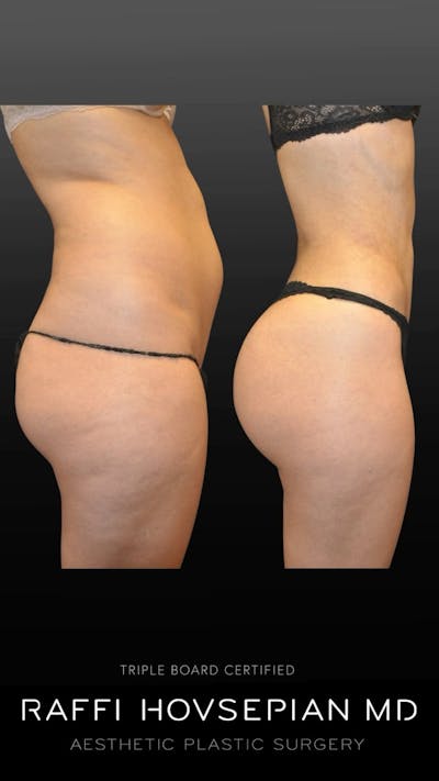 Procedures Before & After Gallery - Patient 206201 - Image 1