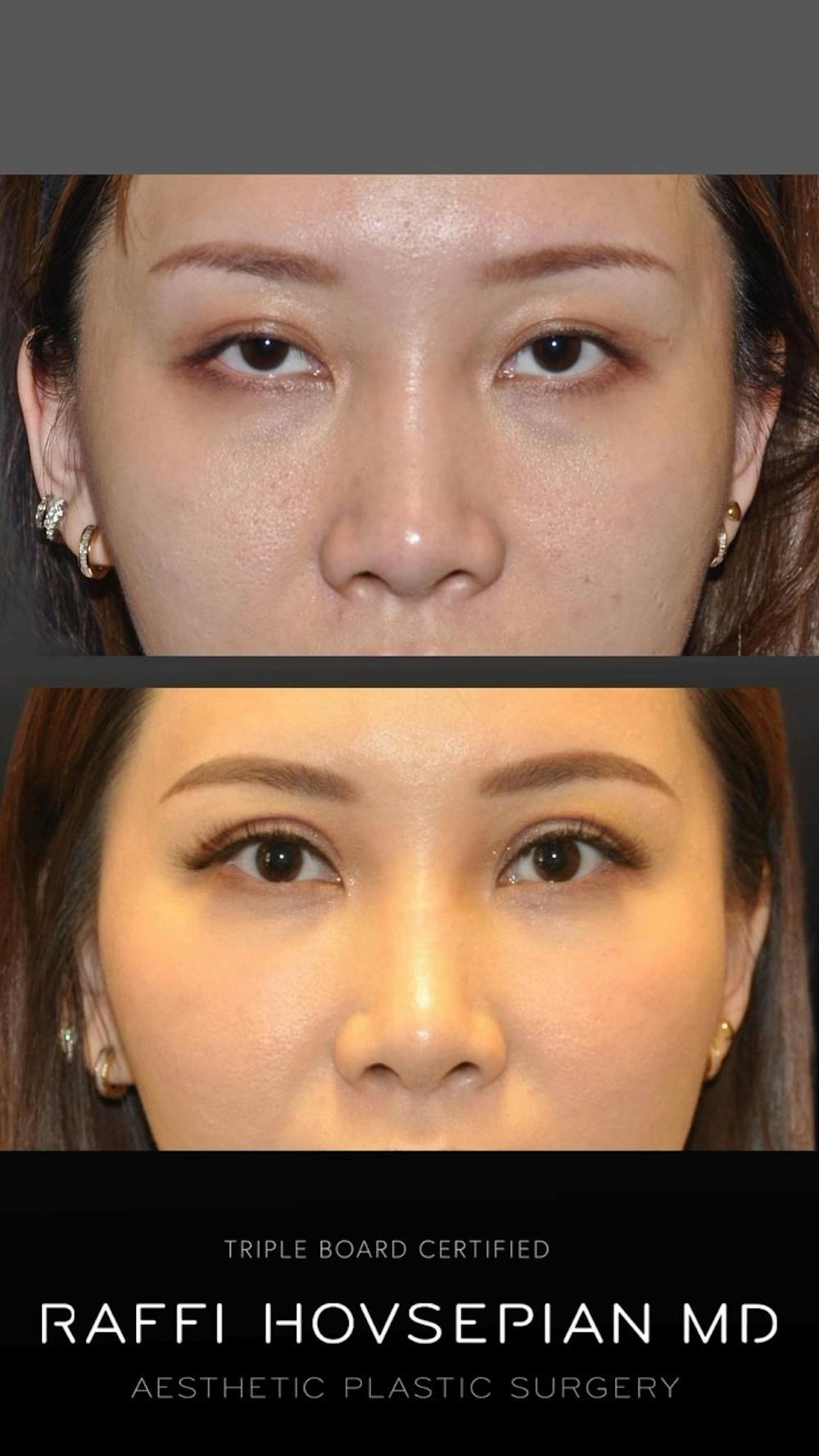 Procedures Before & After Gallery - Patient 389220 - Image 1