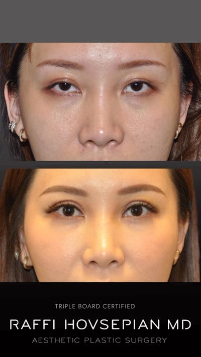 Procedures Before & After Gallery - Patient 389220 - Image 1
