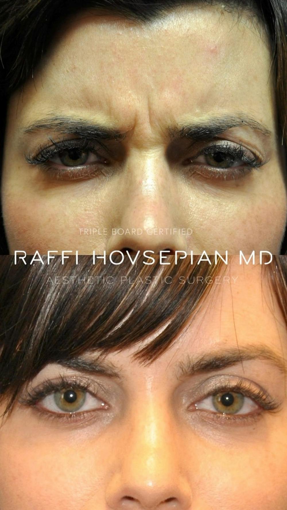 Procedures Before & After Gallery - Patient 318823 - Image 1
