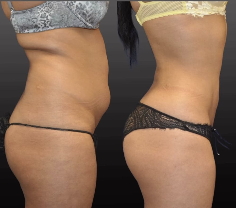 Procedures Before & After Gallery - Patient 101400 - Image 1