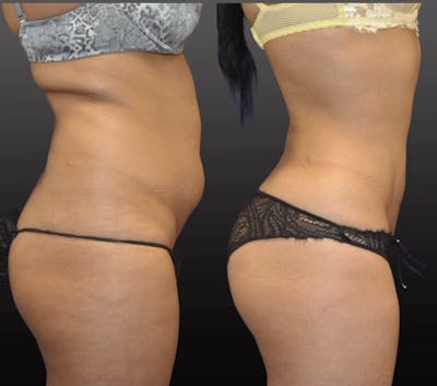 Procedures Before & After Gallery - Patient 101400 - Image 1