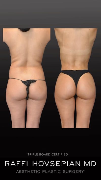 Procedures Before & After Gallery - Patient 300766 - Image 1