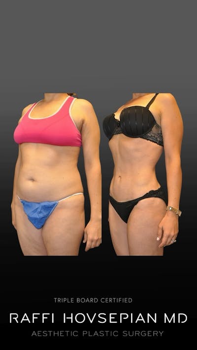 Procedures Before & After Gallery - Patient 100448 - Image 1