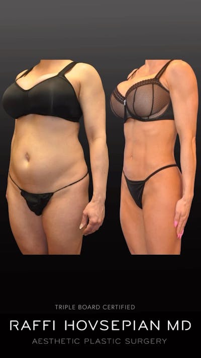 Procedures Before & After Gallery - Patient 276702 - Image 1