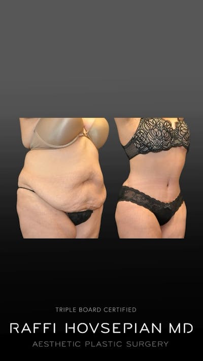 Procedures Before & After Gallery - Patient 896743 - Image 1
