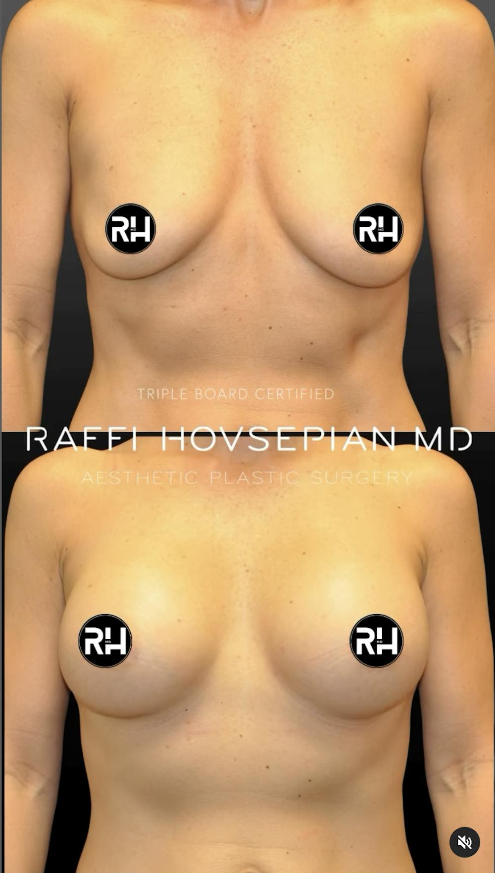 Procedures Before & After Gallery - Patient 413872 - Image 1