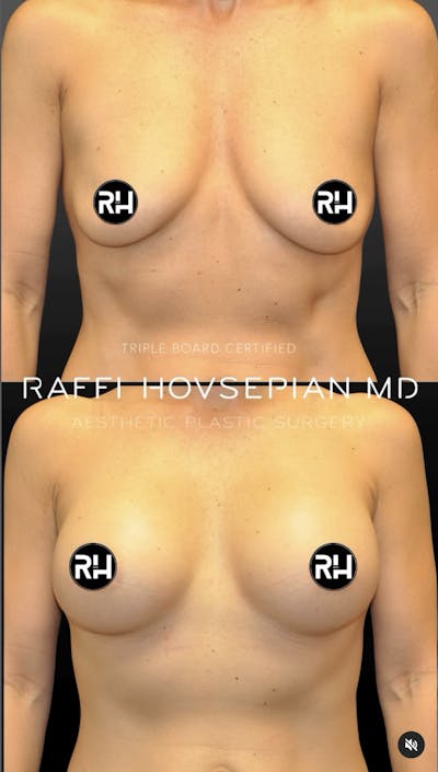 Procedures Before & After Gallery - Patient 413872 - Image 1