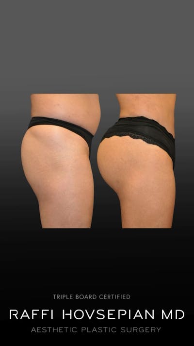 Procedures Before & After Gallery - Patient 631135 - Image 1