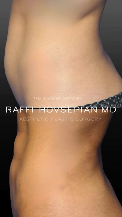 Procedures Before & After Gallery - Patient 265856 - Image 1