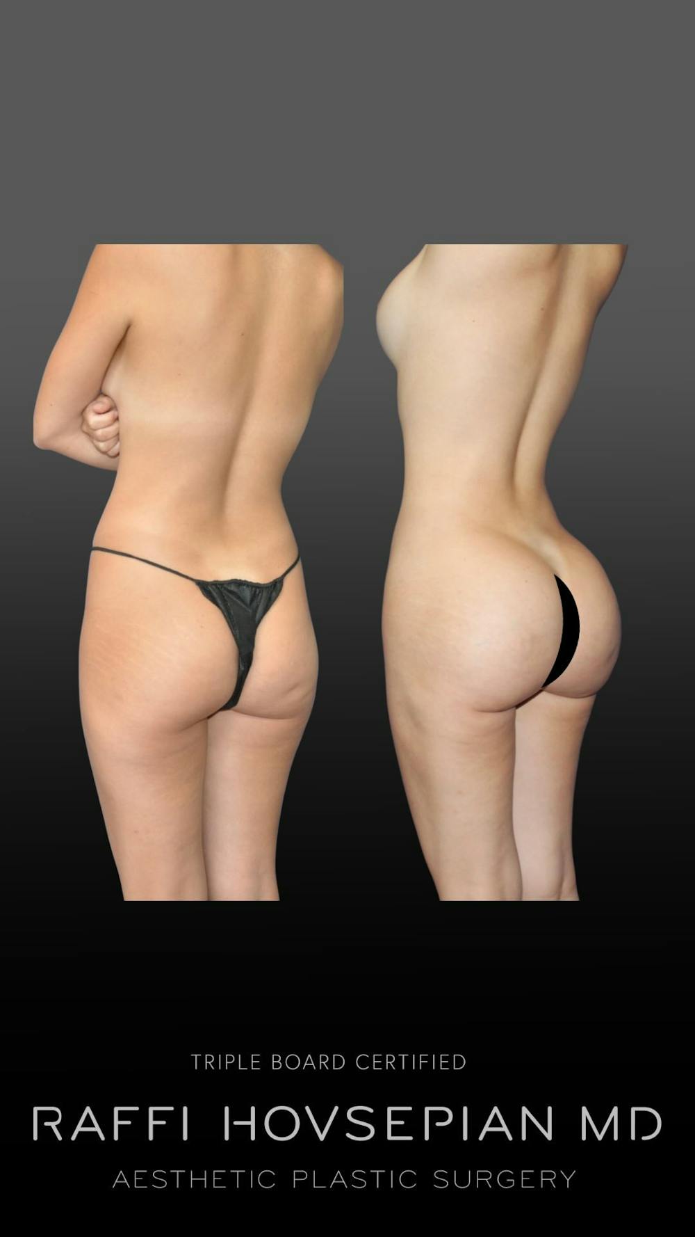 Procedures Before & After Gallery - Patient 143658 - Image 1