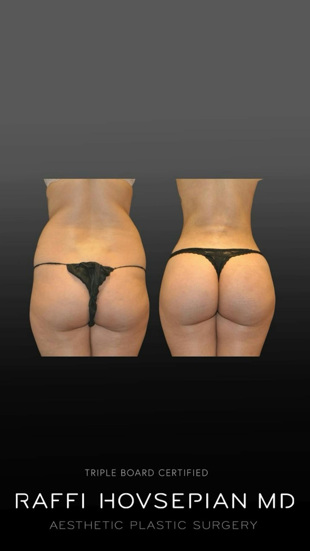 Procedures Before & After Gallery - Patient 370875 - Image 1