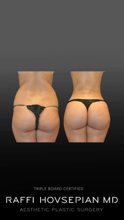 Procedures Before & After Gallery - Patient 370875 - Image 1