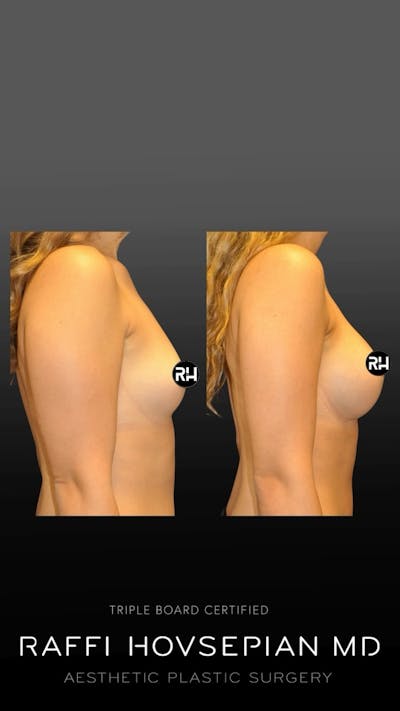 Procedures Before & After Gallery - Patient 121810 - Image 1