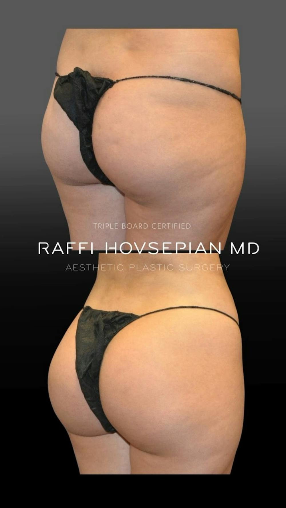 Procedures Before & After Gallery - Patient 688178 - Image 1