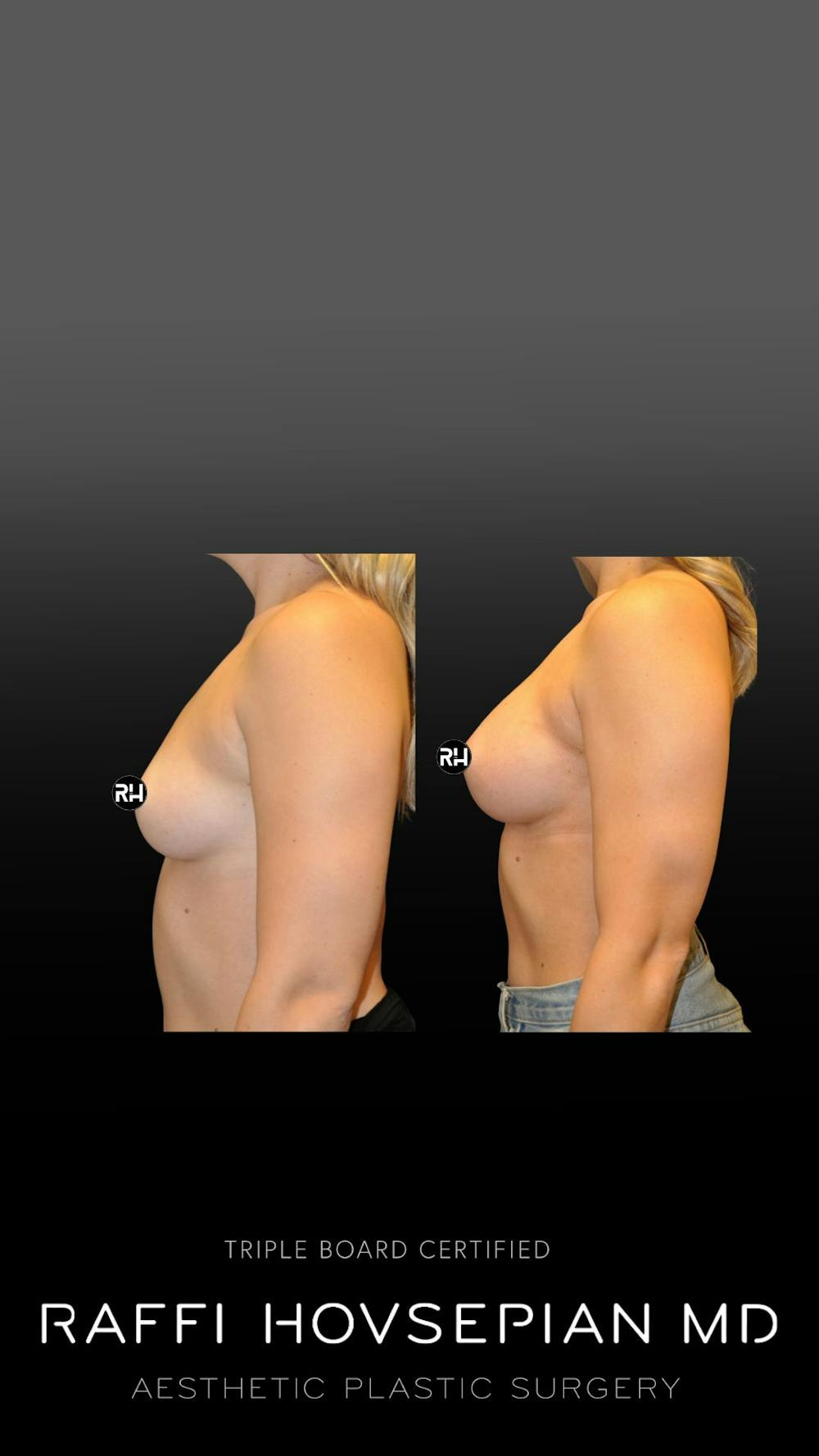 Procedures Before & After Gallery - Patient 206866 - Image 1