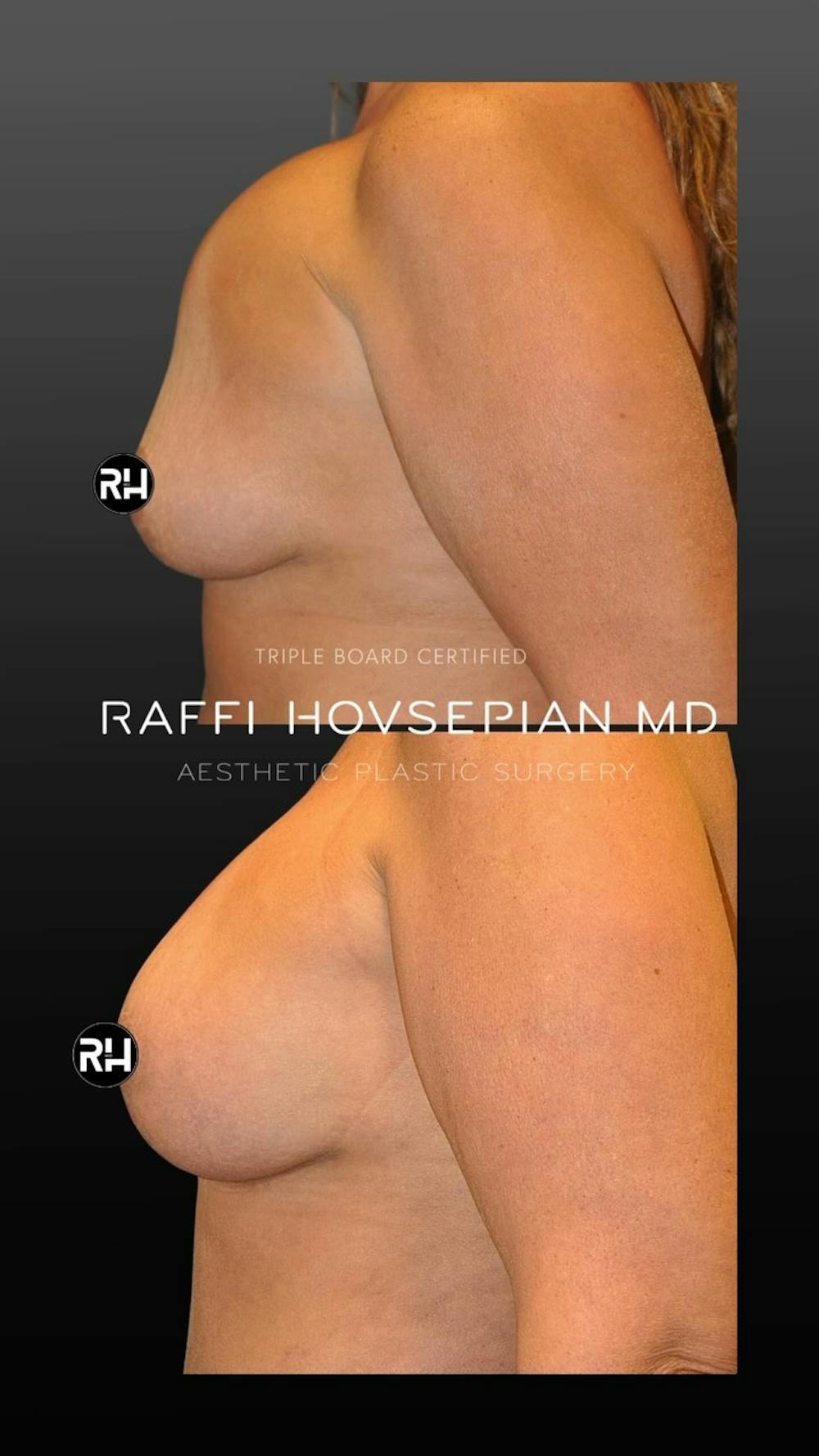 Procedures Before & After Gallery - Patient 246936 - Image 1