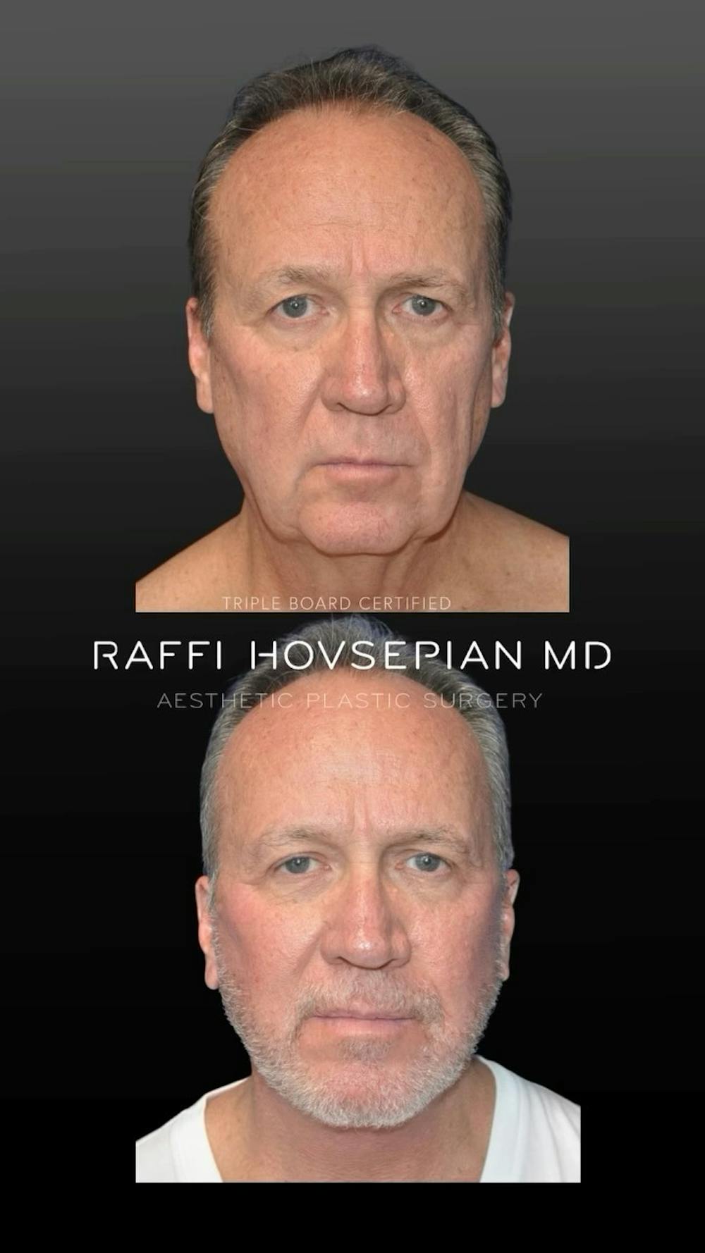 Procedures Before & After Gallery - Patient 189892901 - Image 2