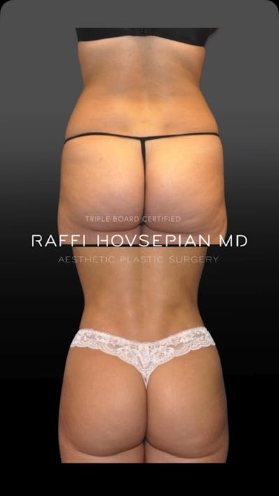 Procedures Before & After Gallery - Patient 117676 - Image 1