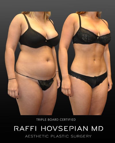 Procedures Before & After Gallery - Patient 984854 - Image 1
