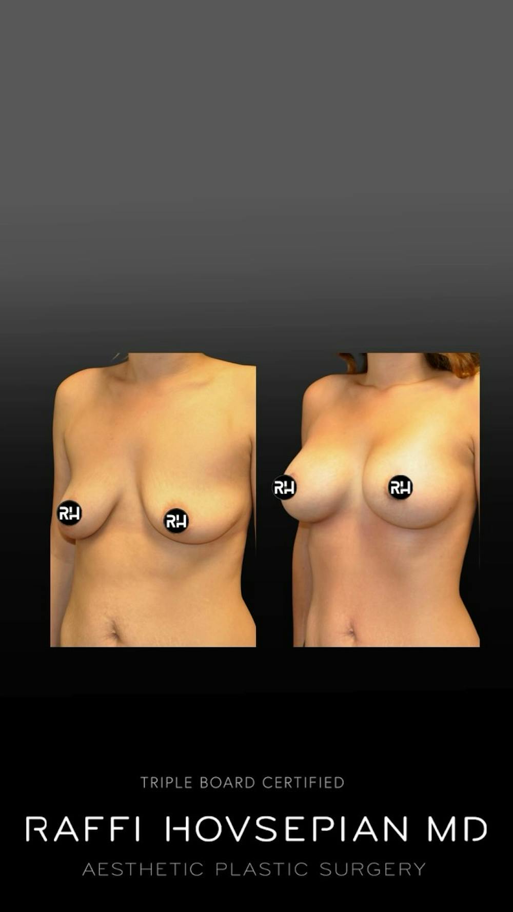 Procedures Before & After Gallery - Patient 323334 - Image 1