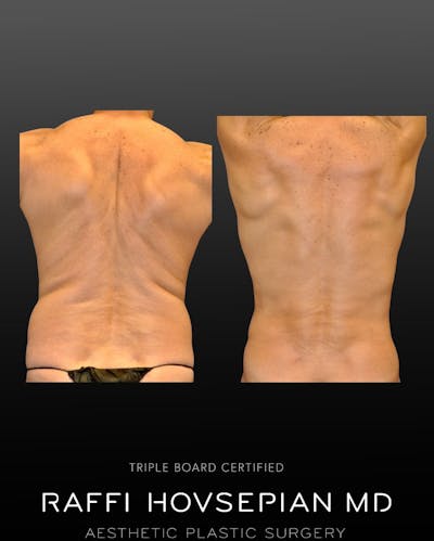 Procedures Before & After Gallery - Patient 926467 - Image 1