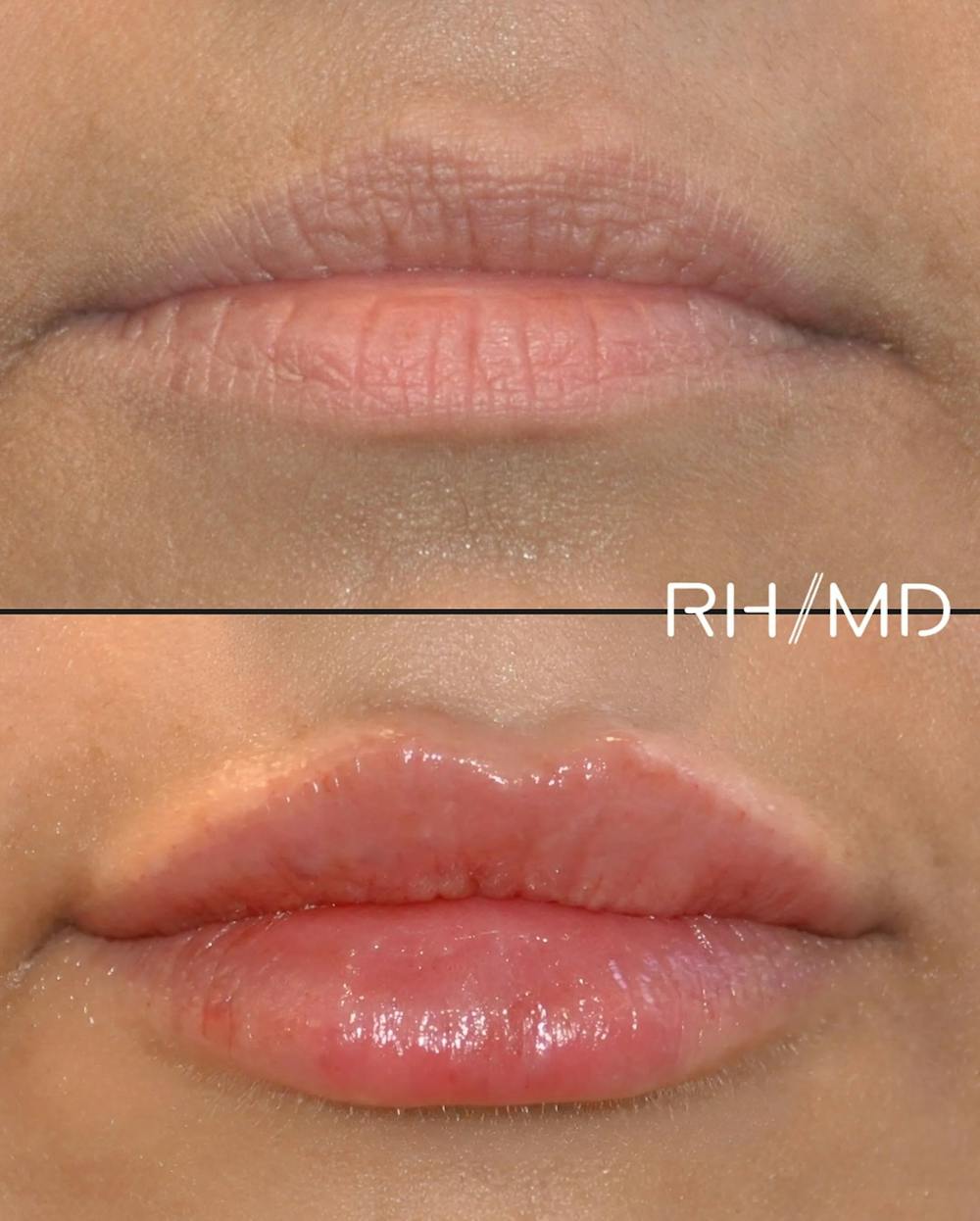 Procedures Before & After Gallery - Patient 366947 - Image 1