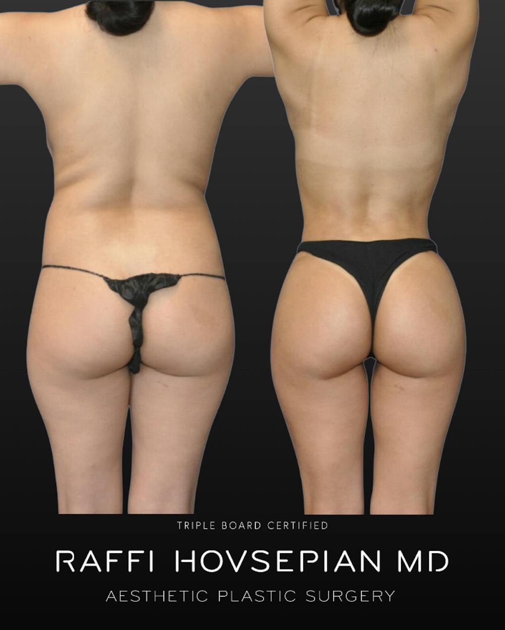 Procedures Before & After Gallery - Patient 410107 - Image 1