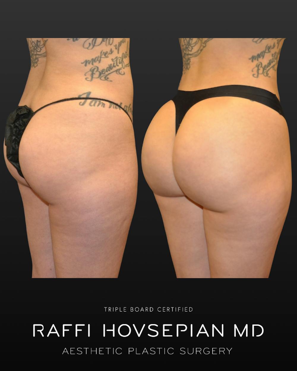 Procedures Before & After Gallery - Patient 131835 - Image 1