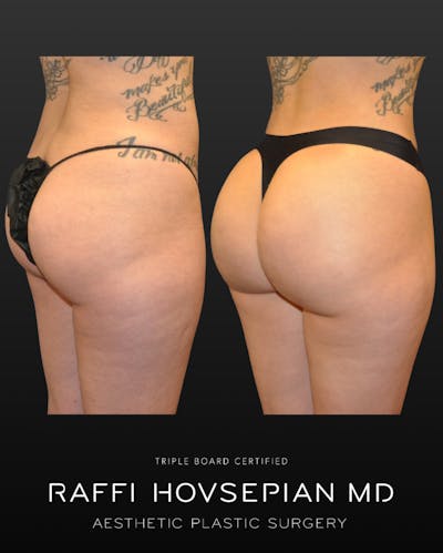Procedures Before & After Gallery - Patient 131835 - Image 1