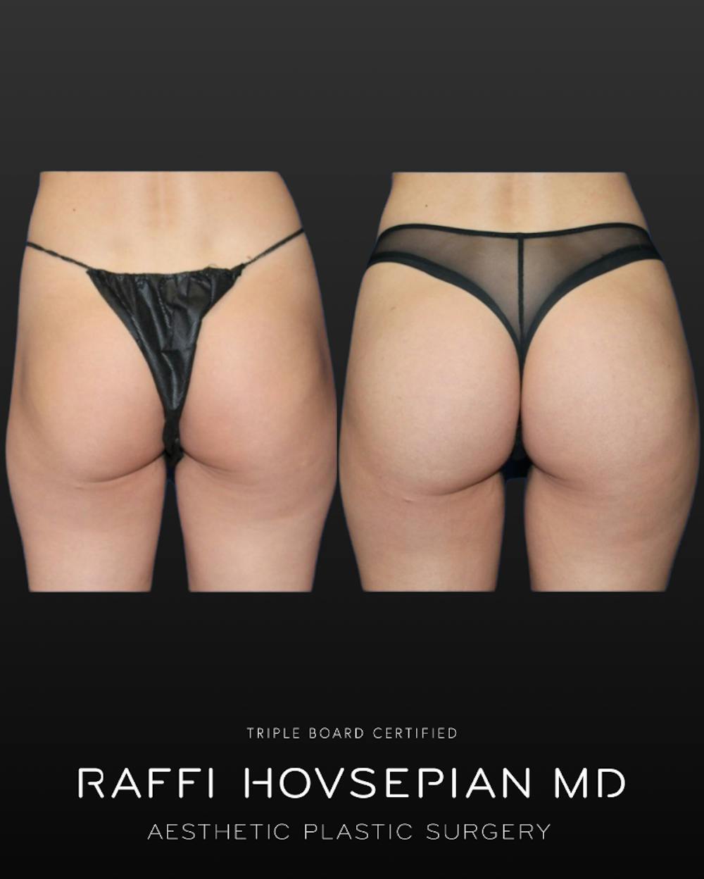 Procedures Before & After Gallery - Patient 242109 - Image 2