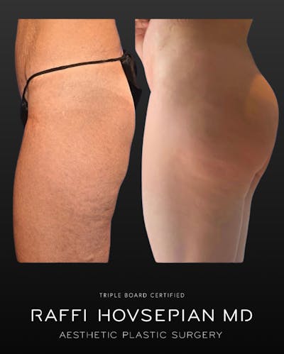Procedures Before & After Gallery - Patient 116086 - Image 1