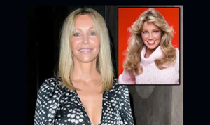 Raffi Hovsepian, MD Blog | Still Stunning! Heather Locklear Is Fighting Back Time With 'Botox And Fillers' Says Plastic Surgeon