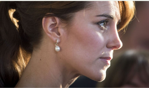 Raffi Hovsepian, MD Blog | Kate Middleton's Nose: A Hot Accessory for Spring?