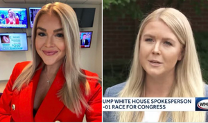 Raffi Hovsepian, MD Blog | Dr. Raffi Hovsepian Weighs in on Side-by-Side Photos of Karoline Leavitt's Jarring Transformation 