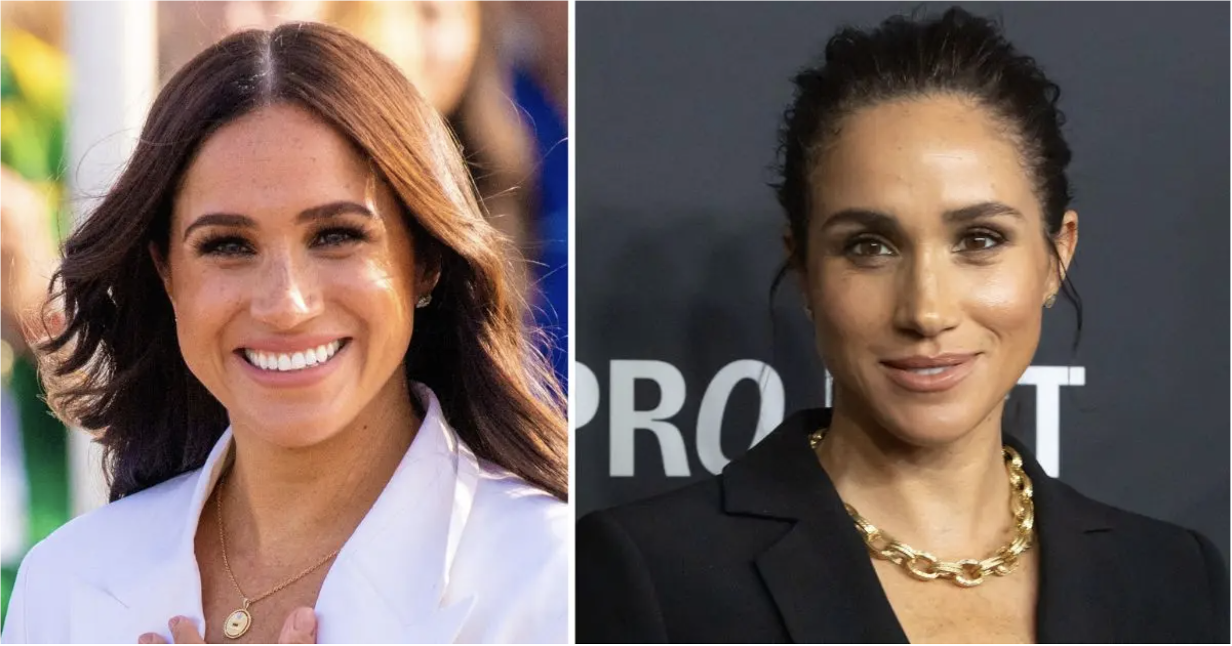 Raffi Hovsepian, MD Blog | EXCLUSIVE: Meghan Markle's Plastic Surgery Rumors Explode as Top Doc Points to Duchess' 'Lifted Lids, Higher Crease and Sculpted Eyes' in Shocking Before-and-After Shift