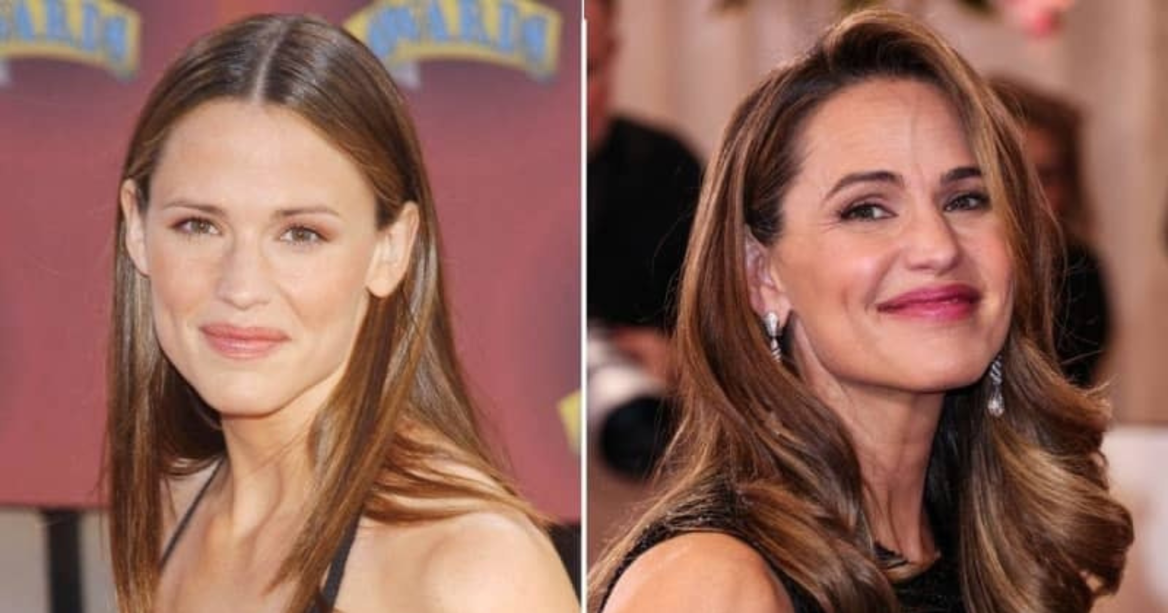Raffi Hovsepian, MD Blog | EXCLUSIVE: 'Medical-Grade Skincare' BUT No Plastic Surgery — How Jennifer Garner, 53, Has Maintained an 'Exceptional' Ageless Appearance