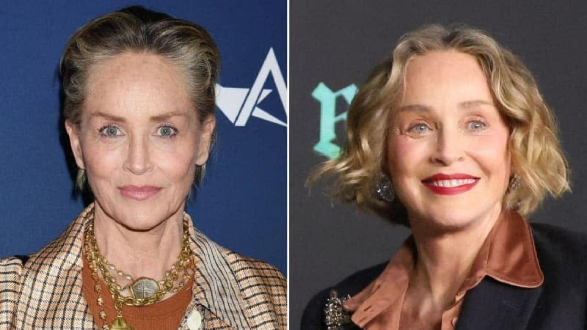 Raffi Hovsepian, MD Blog | EXCLUSIVE: Sharon Stone's Startling 'New Face' Explained — Legendary Actress Underwent 'Volumizing  Treatments,  ' Plastic Surgeon Claims