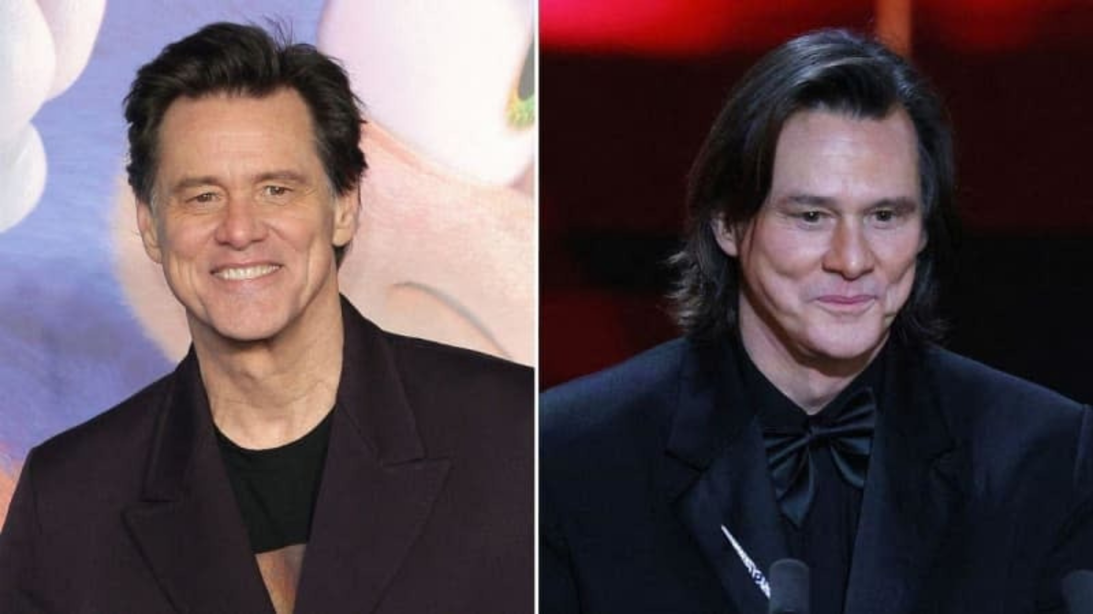 Raffi Hovsepian, MD Blog | EXCLUSIVE: Secrets of Jim Carrey's 'Unrecognizable New Face' Revealed — With Top Plastic Surgeon Suggesting Actor Got 'Hyaluronic Acid Filler or  Volumizing Treatments'
