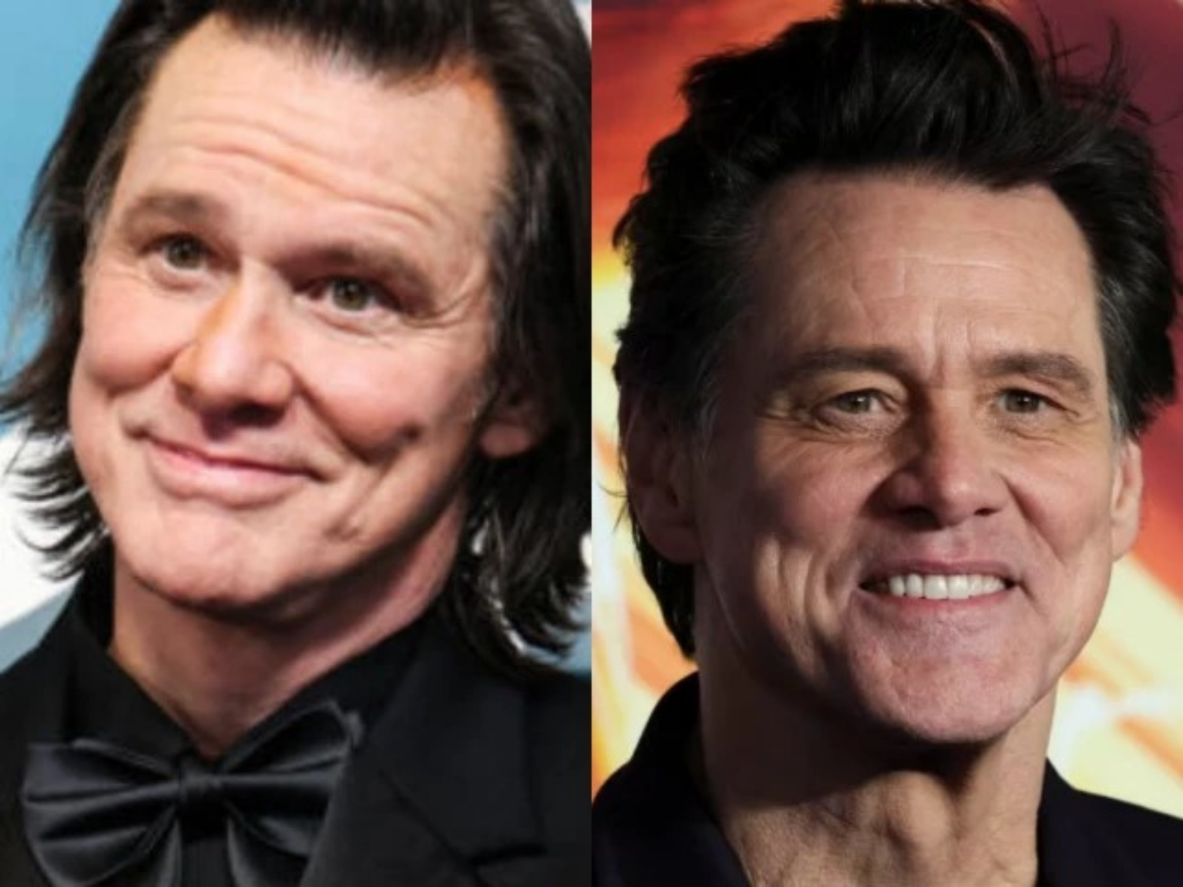 Raffi Hovsepian, MD Blog | Is Jim Carrey’s unrecognisable new look the result of acid  fillers? Plastic surgeon weighs in