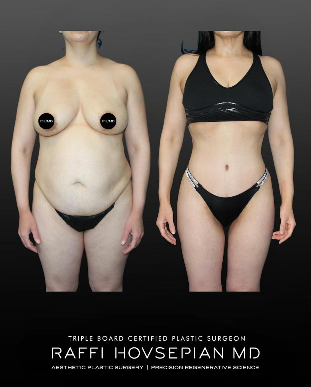 Procedures Before & After Gallery - Patient 389713 - Image 2