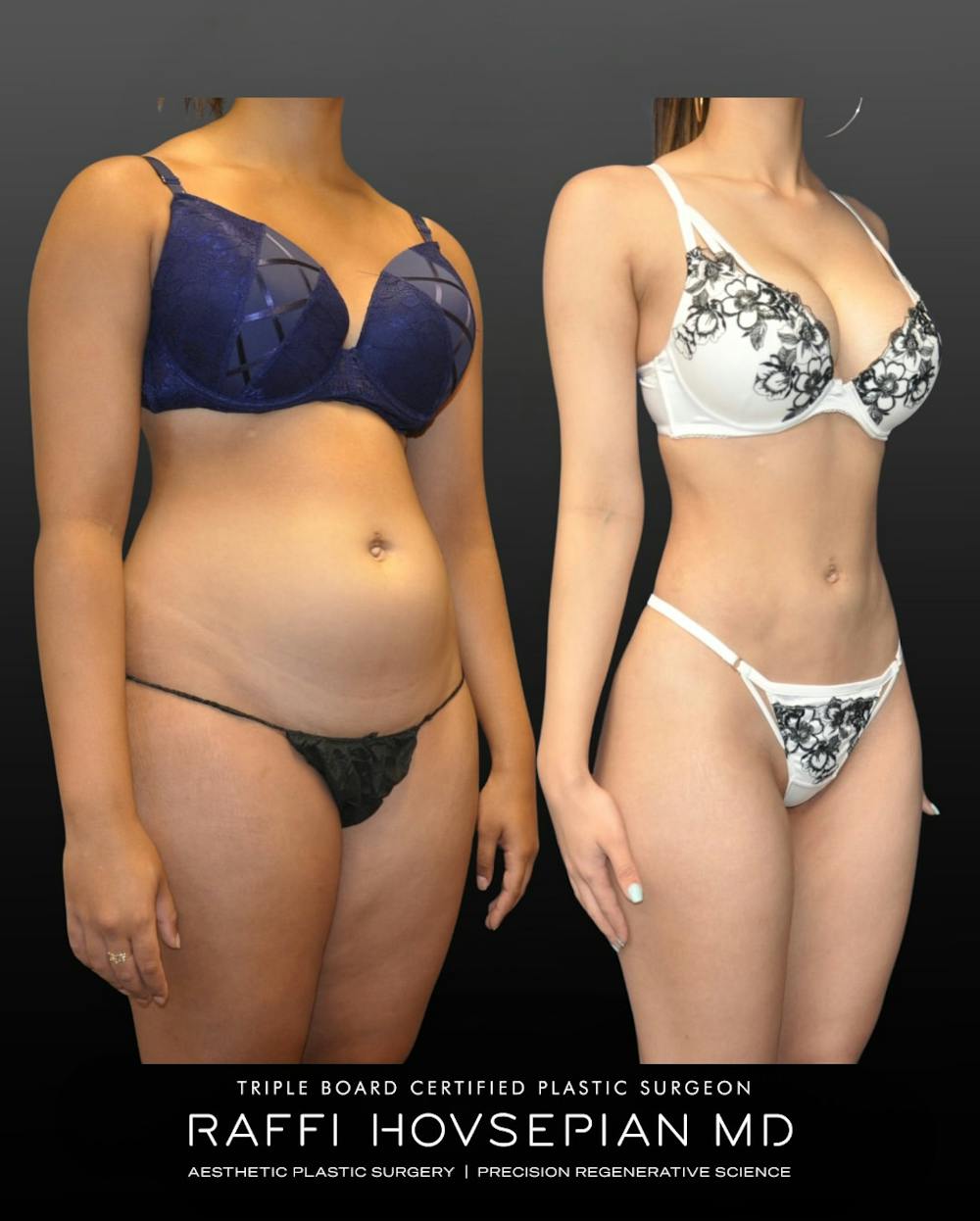 Procedures Before & After Gallery - Patient 419222 - Image 2