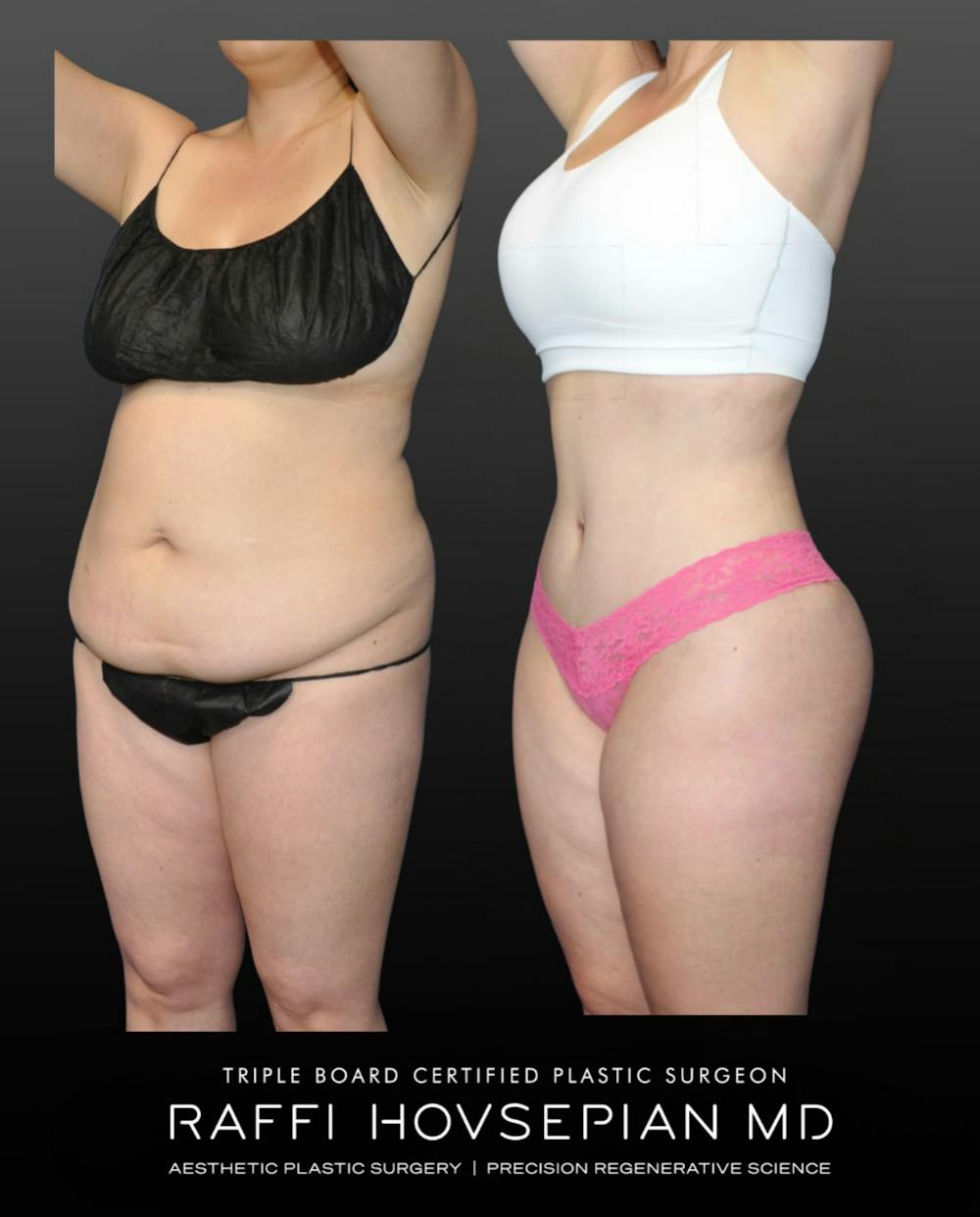 Procedures Before & After Gallery - Patient 210553 - Image 2
