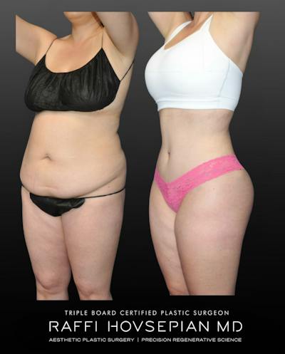 Procedures Before & After Gallery - Patient 210553 - Image 1