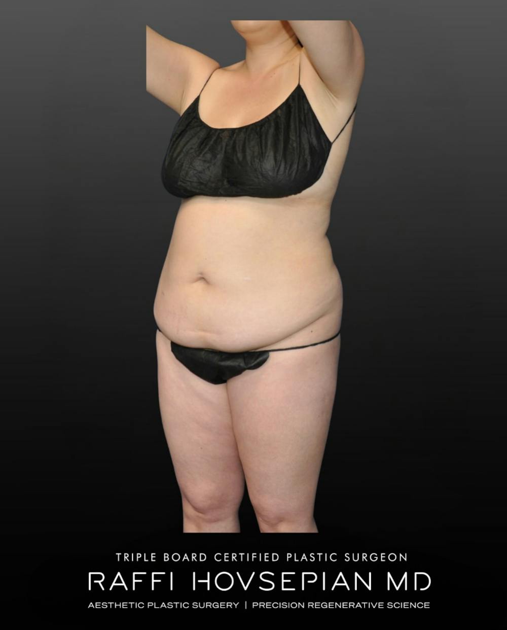 Procedures Before & After Gallery - Patient 210553 - Image 1